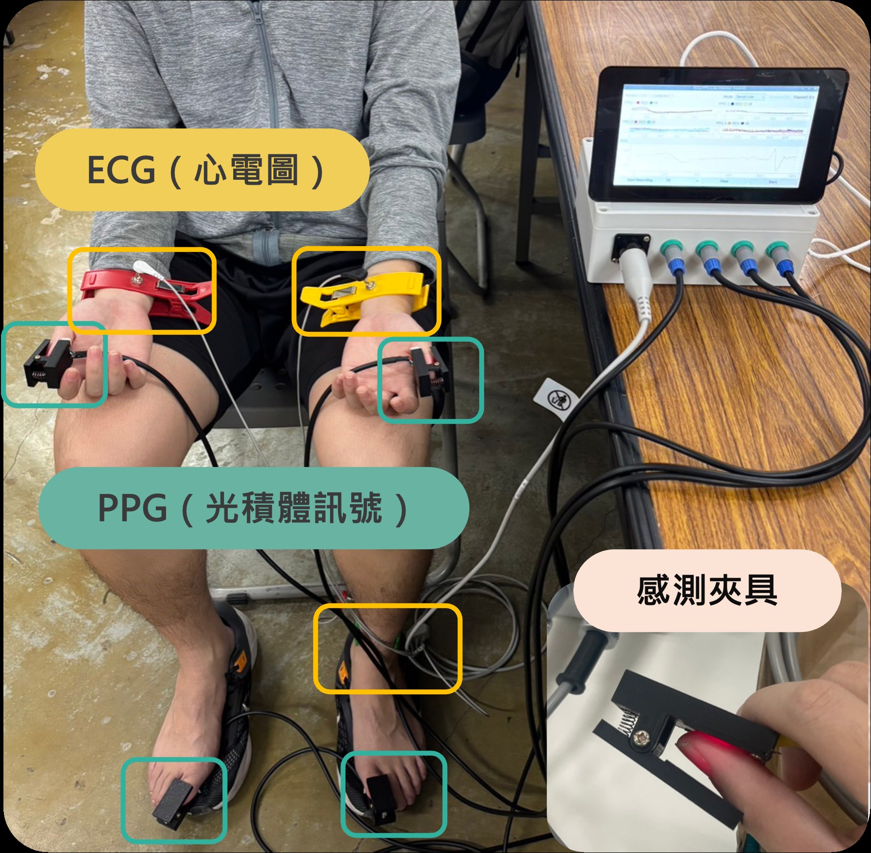智慧型周邊循環即時監測系統產品化 Commercialize Peripheral Vascular Monitoring System